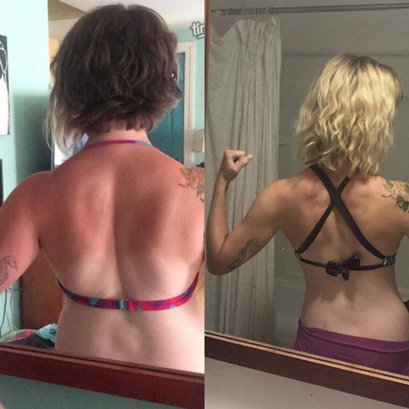 before and after back definition